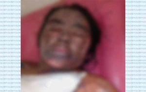 কানাইঘাটে গর্ভবতী স্ত্রীকে পুড়িয়ে মারার চেষ্টা, সন্তানের মৃত্যু